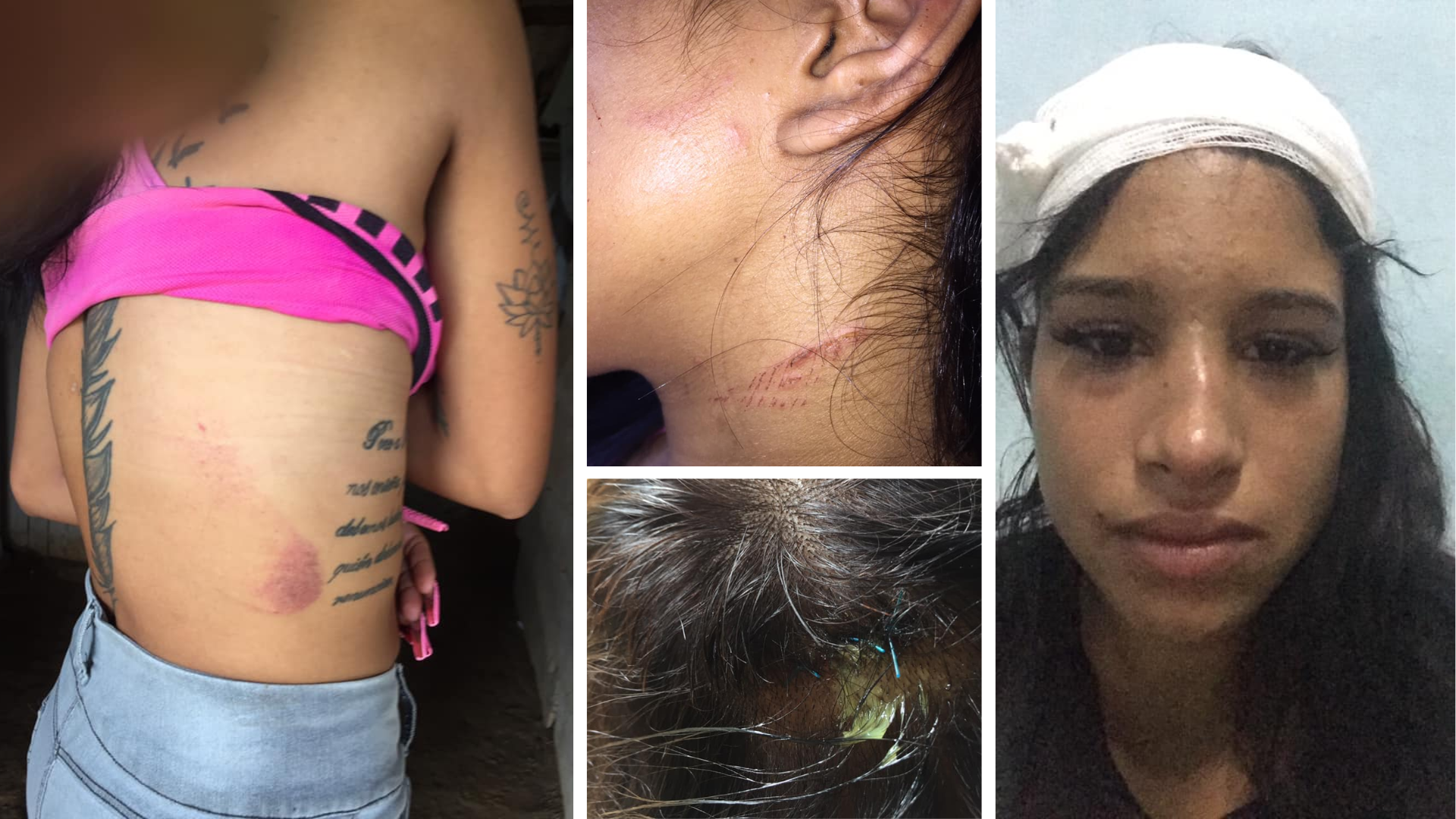 Joven cubana sufrió fuerte agresión en Ciego de Ávila