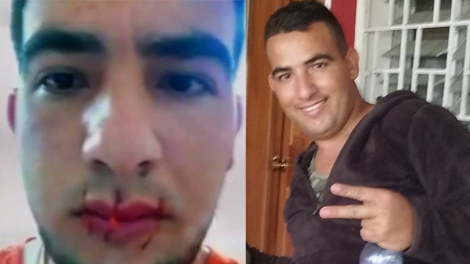 Cubano se cose la boca al no recibir asilo político en Estados Unidos