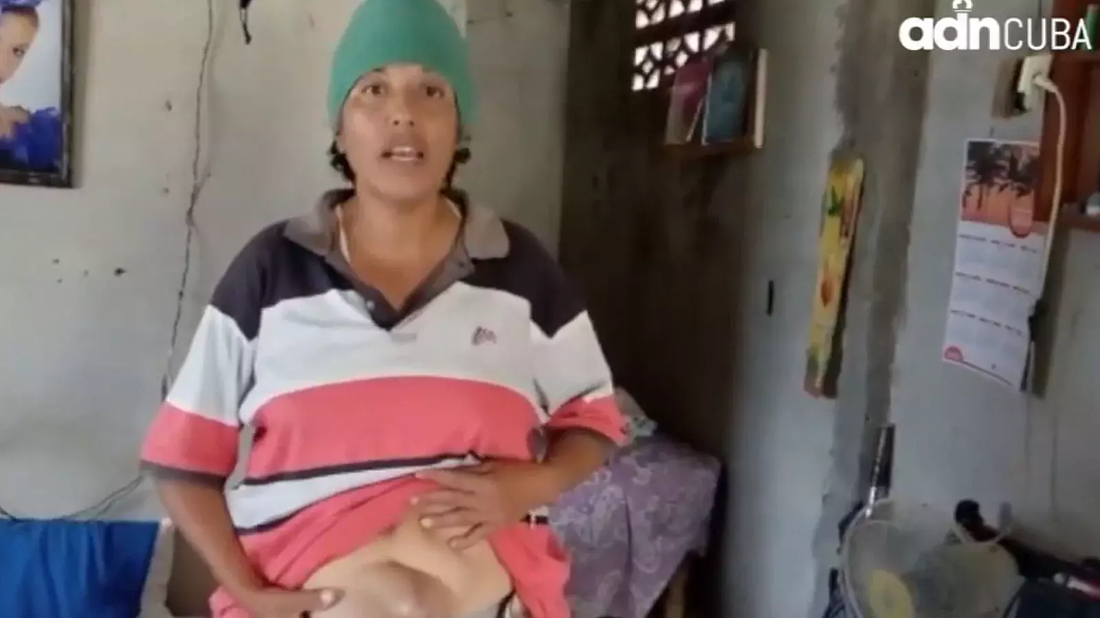 La mujer tiene esta hernia como consecuencia de otra cirugía &quot;en la cual no me pusieron malla y todo ese hilo se me fue&quot;, contó a ADN Cuba