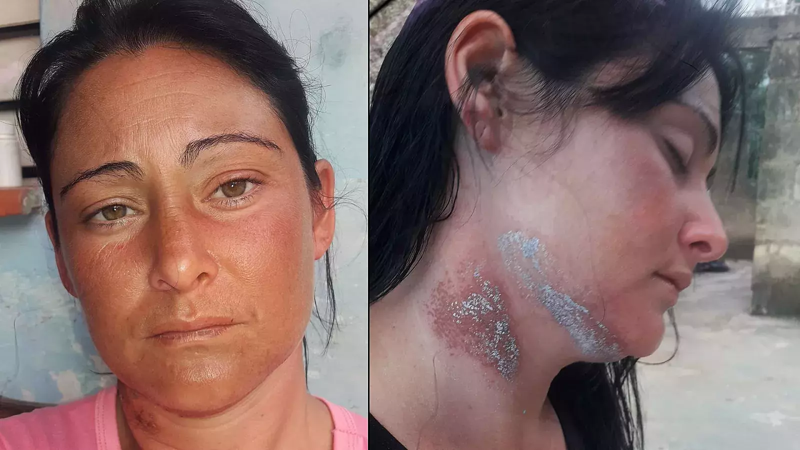 Yailyn Mesa Vázquez, sobreviviente de naufragio en Cuba