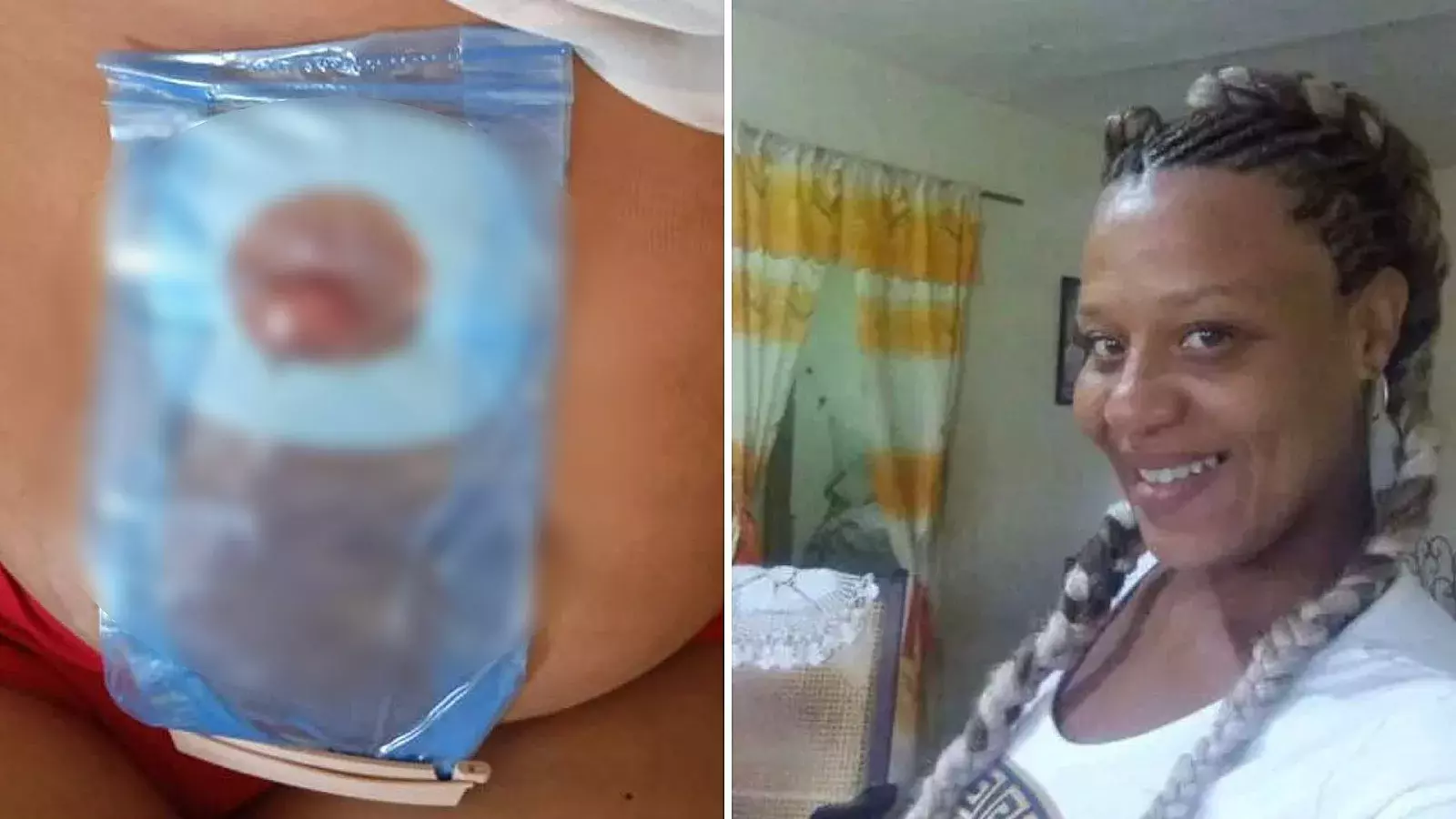 En los últimos años se ha hecho común que decenas de cubanos pacientes de cáncer acudan a redes sociales y medios independientes para pedir ayuda para sus tratamientos