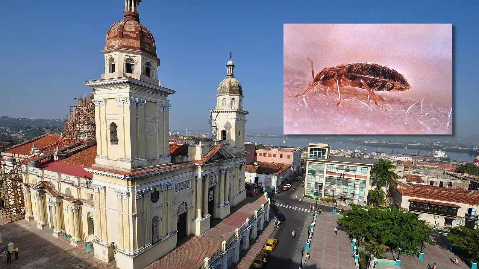 Plaga de chinches en Santiago de Cuba