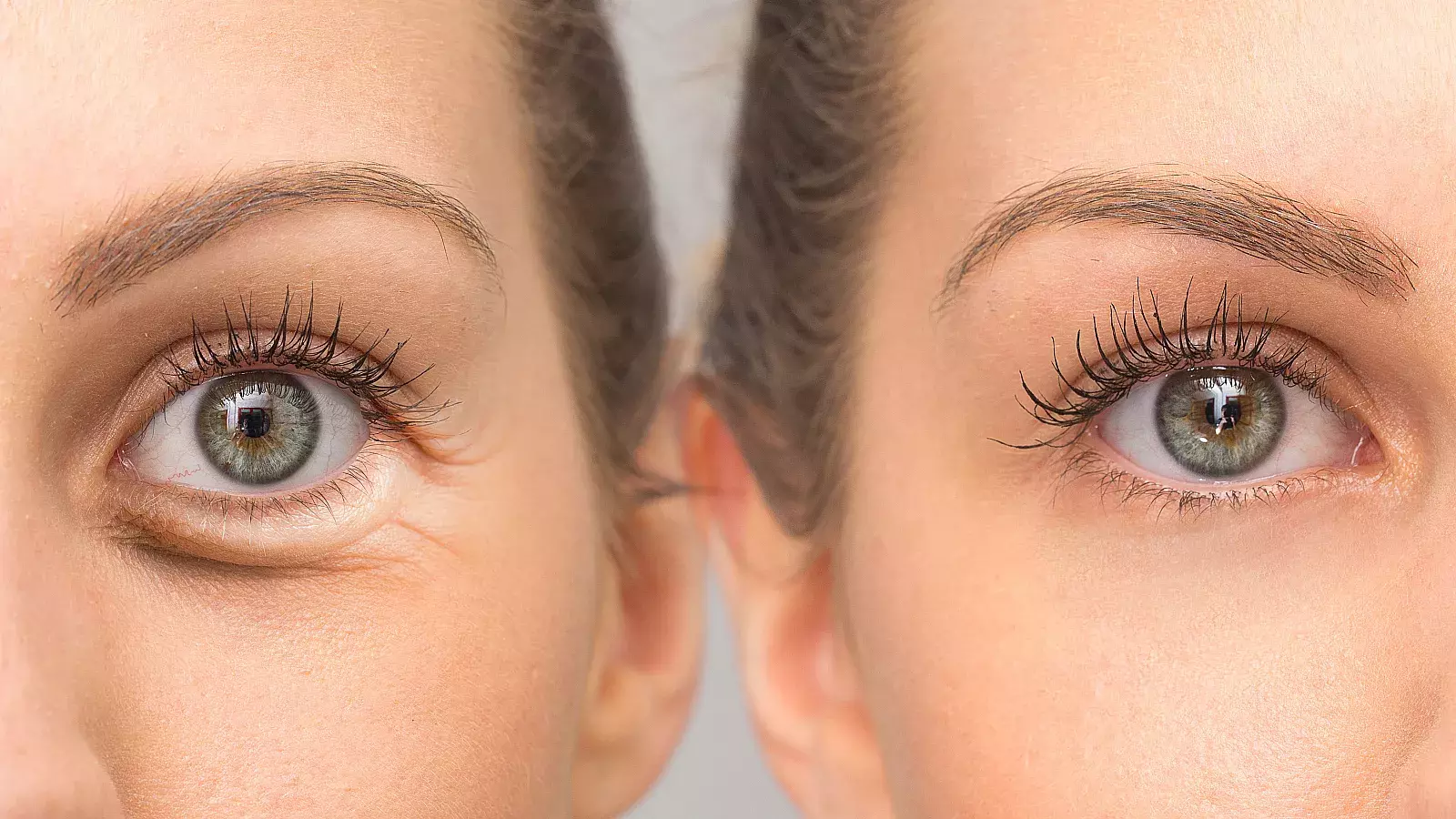 ¿Cómo reducir las bolsas debajo de los ojos de forma natural?