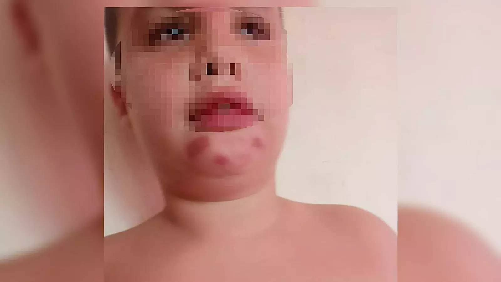 Niño autista sin dieta alimenticia en Cuba