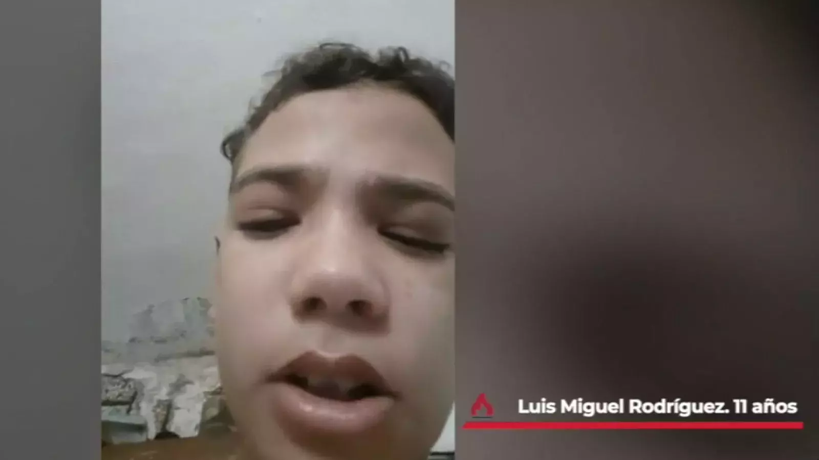 Niño cubano pide ayuda para su vista.