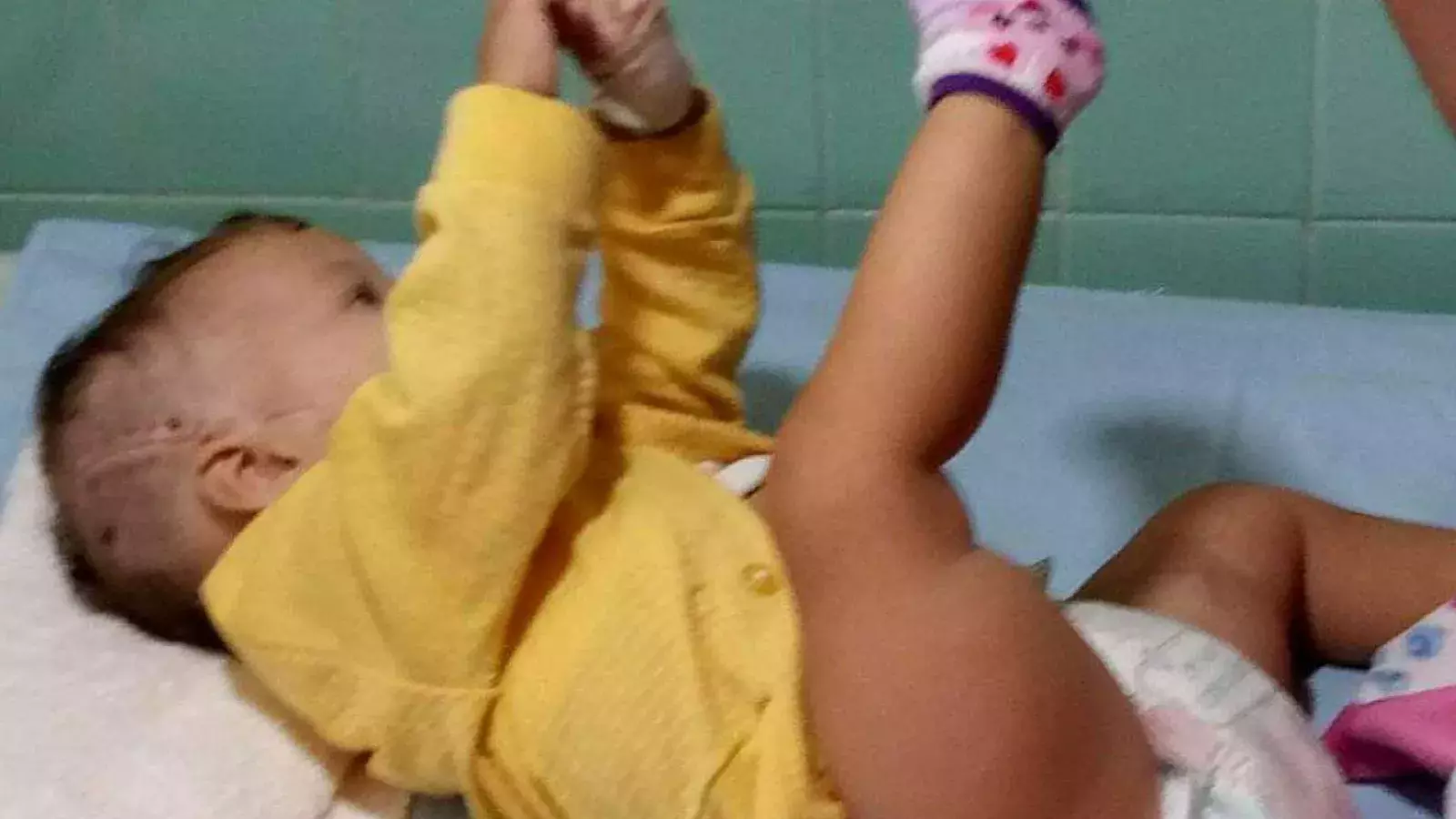 Bebe accidentada