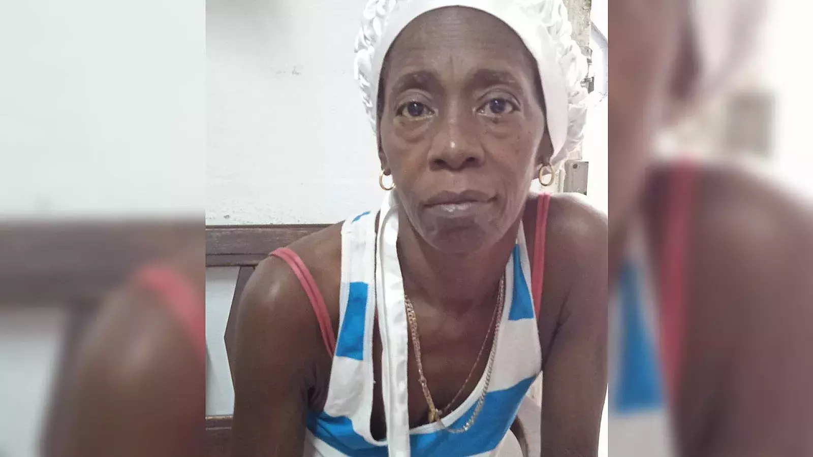 Cubana necesita bolsas de colostomía