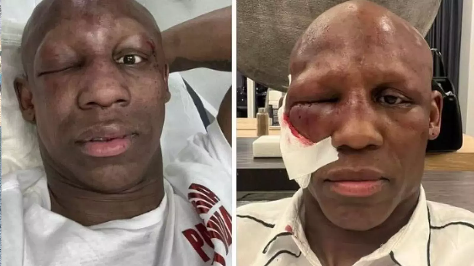 Yordenis Ugás, boxeador cubano