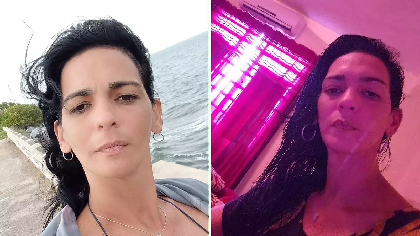 Cubana necesita marcapasos nuevo