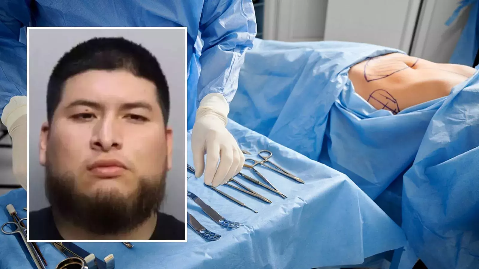 Hombre acusado de voyerismo y agresión física contra paciente sedada tras cirugía estética en Florida