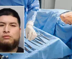 Hombre acusado de voyerismo y agresión física contra paciente sedada tras cirugía estética en Florida