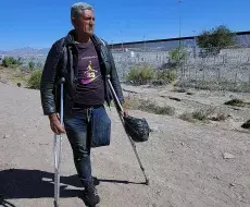 Venezolano llega con una sola pierna a la frontera de México en busca de una prótesis en EEUU