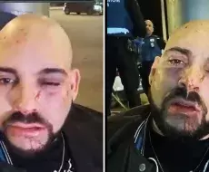 &quot;Esto es obra de la dictadura&quot;: activista Lázaro Mireles denuncia golpiza en Madrid