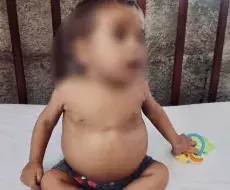 Bebé cubano que necesita trasplante de hígado